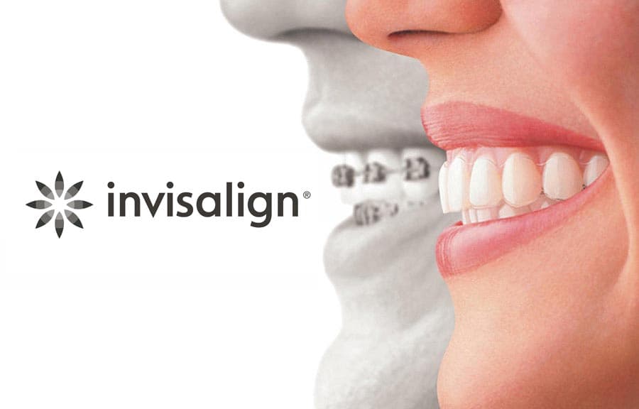 Invisalign®